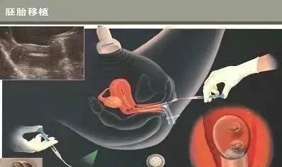 浙江省妇幼保健医院